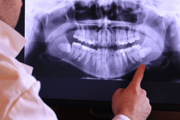 Best Walk-In Emergency Dental Services in Red Corral, CA